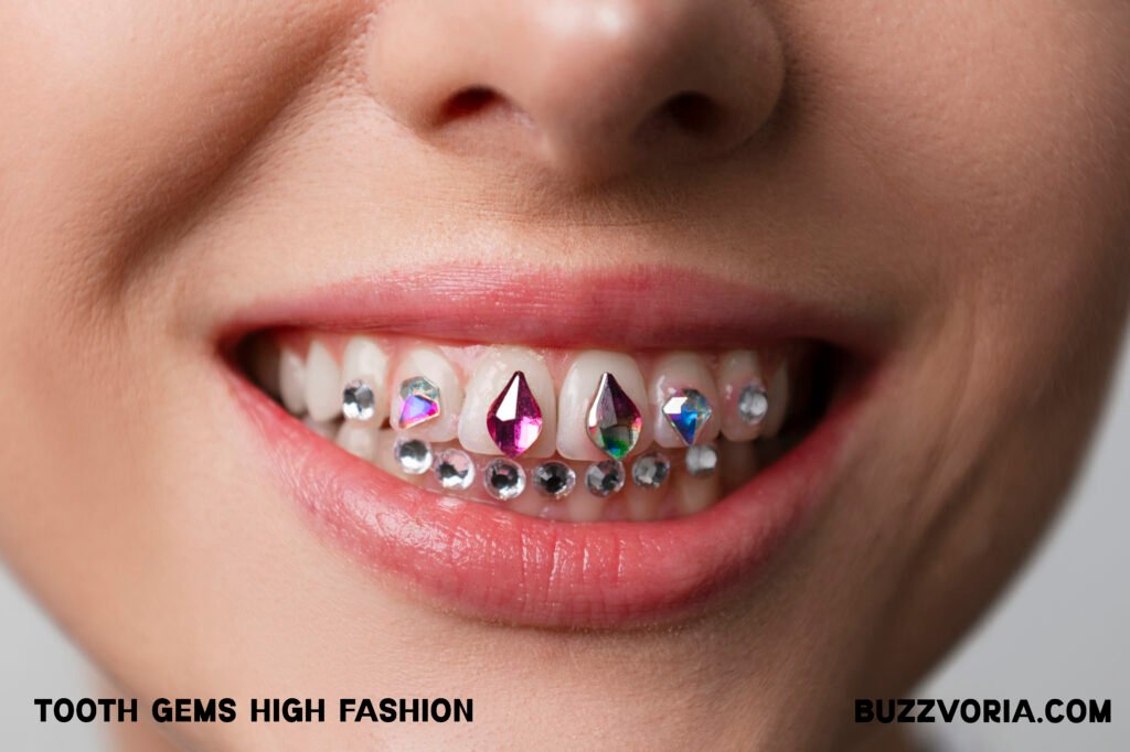 Tooth Gems High Fashion